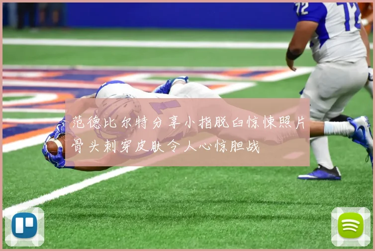 范德比尔特分享小指脱臼惊悚照片骨头刺穿皮肤令人心惊胆战